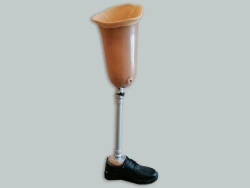 Modular Hip Prosthesis for Congenital Underdevelopment