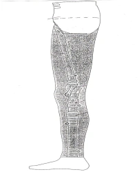 Modular Hip Disarticulation Prosthesis