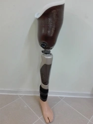 Modular Microprocessor-Controlled Hip Prosthesis