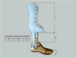 Custom Non-Modular Below-Knee Prosthesis for Congenital Underdevelopment