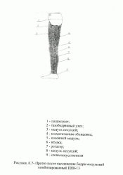 Modular Prosthesis for Hip Disarticulation PN8-13