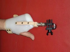 Functional Hand Prosthesis for Partial and Complete Amputation