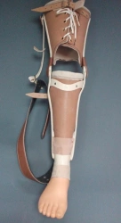Non-modular lower leg prosthesis PN3-N.1 for short and variable volume stumps