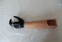 Microprocessor-Controlled Forearm Prosthesis PR2-VIE