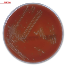 Triptycase Soy Agar Medium for Culturing Microorganisms