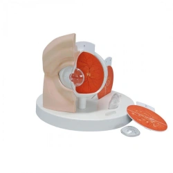 Eye Model with Pathologies, 17110