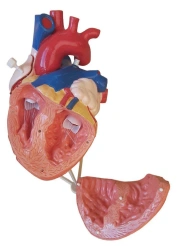 Enlarged Heart Model 2:1, ROST-heart