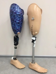 Modular Hip Prosthesis for Individuals with Amputation or Congenital Deficiencies 8-07-10