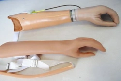 Active Forearm Prosthesis (Tension Type)