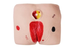 Pressure Ulcer Care Model Set, NS6026