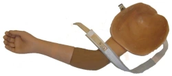 Functional-Cosmetic Arm Prosthesis after Amputation