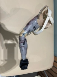 Functional Shoulder Prosthesis - Compliant with Russian Standards