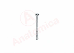 Cannulated Bone Screw for Fracture Fixation