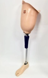 Modular Hip Prosthesis for Amputation Cases