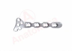 Distal Radius Bone Plate with Angular Stability