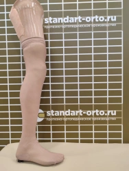 Modular Hip Prosthesis for Congenital Underdevelopment