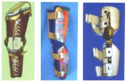 Knee Joint Rehabilitation Device - Custom Made