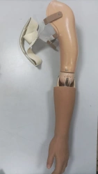 Cosmetic Arm Prosthesis Custom Made
