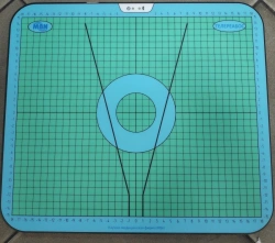 TeleRehab Diagnostic and Rehabilitation Stabilometric Complex