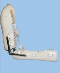 Orthopedic Devices for Wrist, Elbow, and Shoulder Joints
